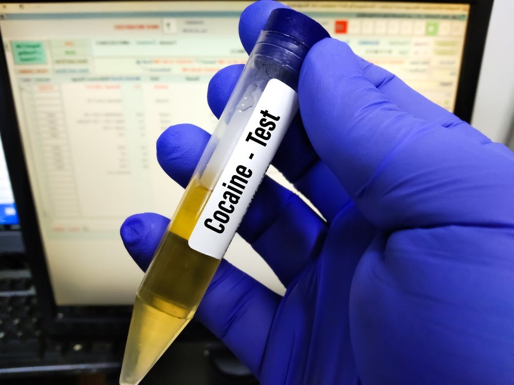Lab Sample of urine for cocaine drug use