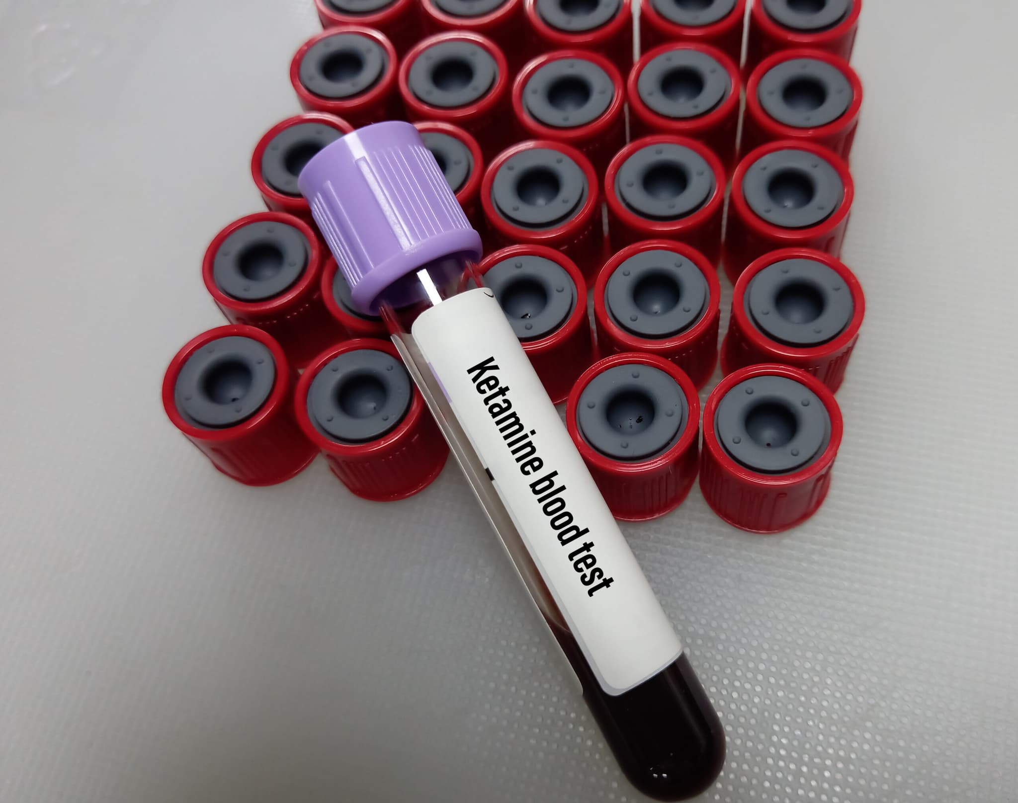 How Long Does Ketamine Stay in Your System? Zinnia Health