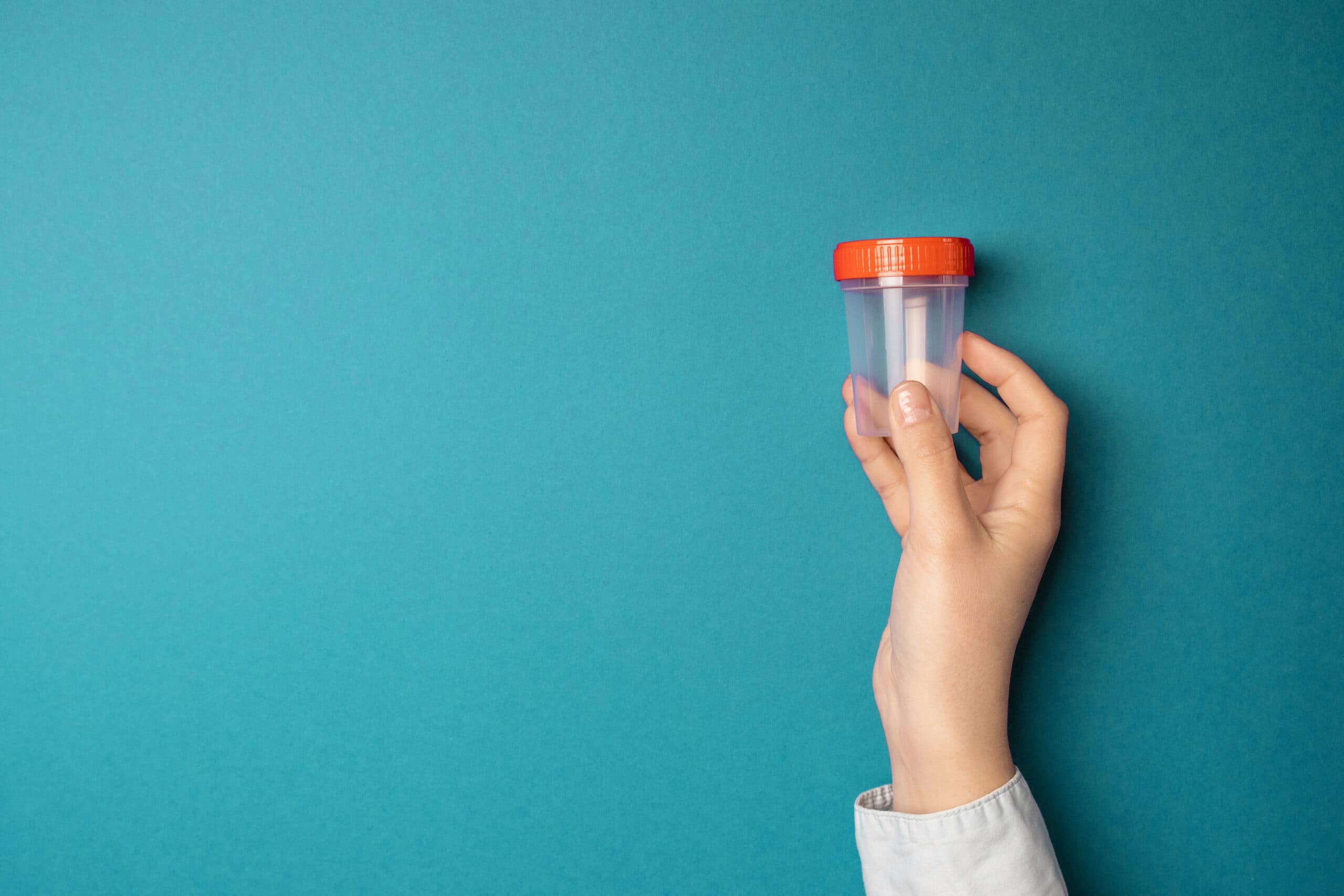 doctor hand holds empty urine drug test