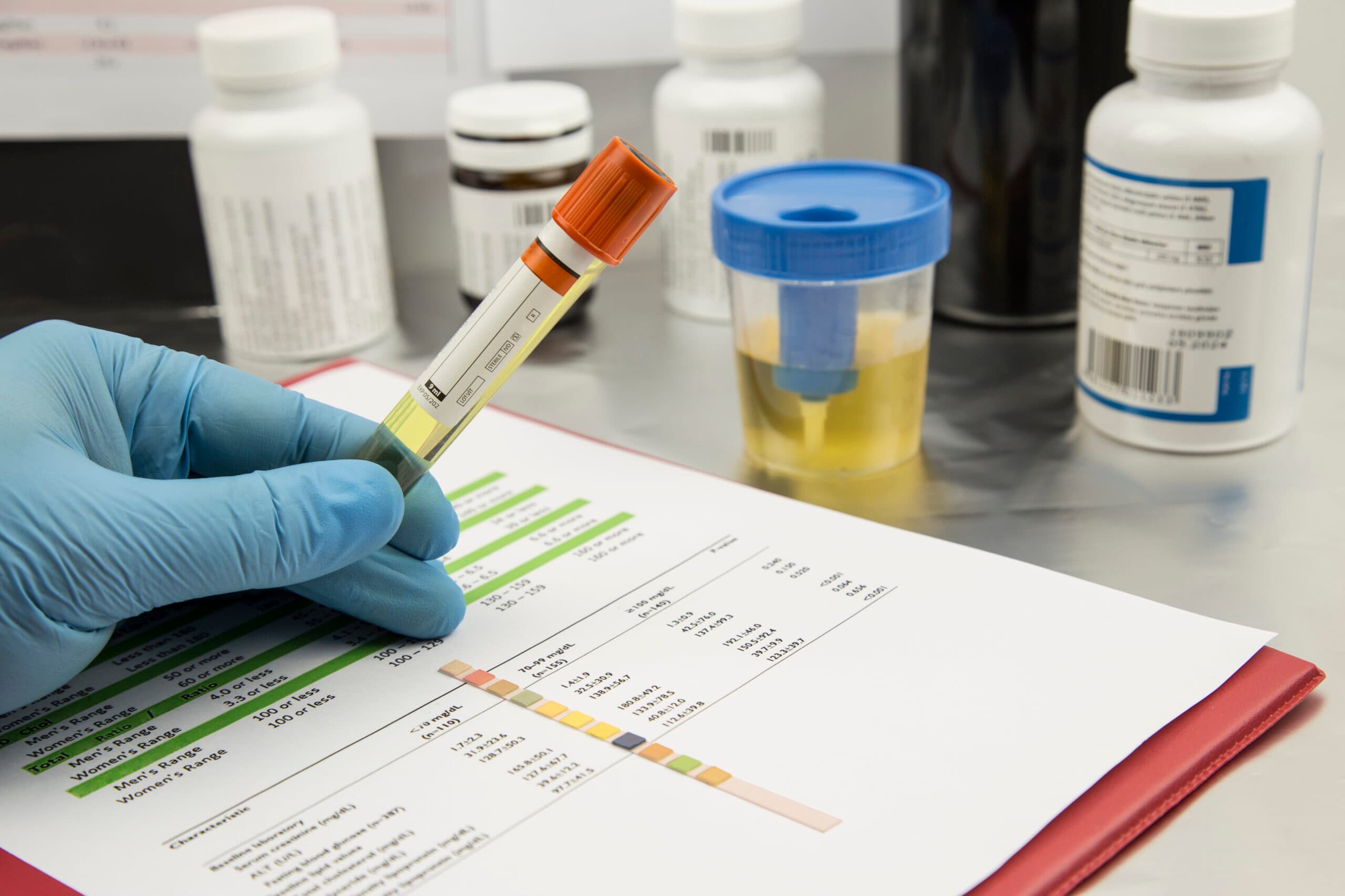 percocet panel urine drug test