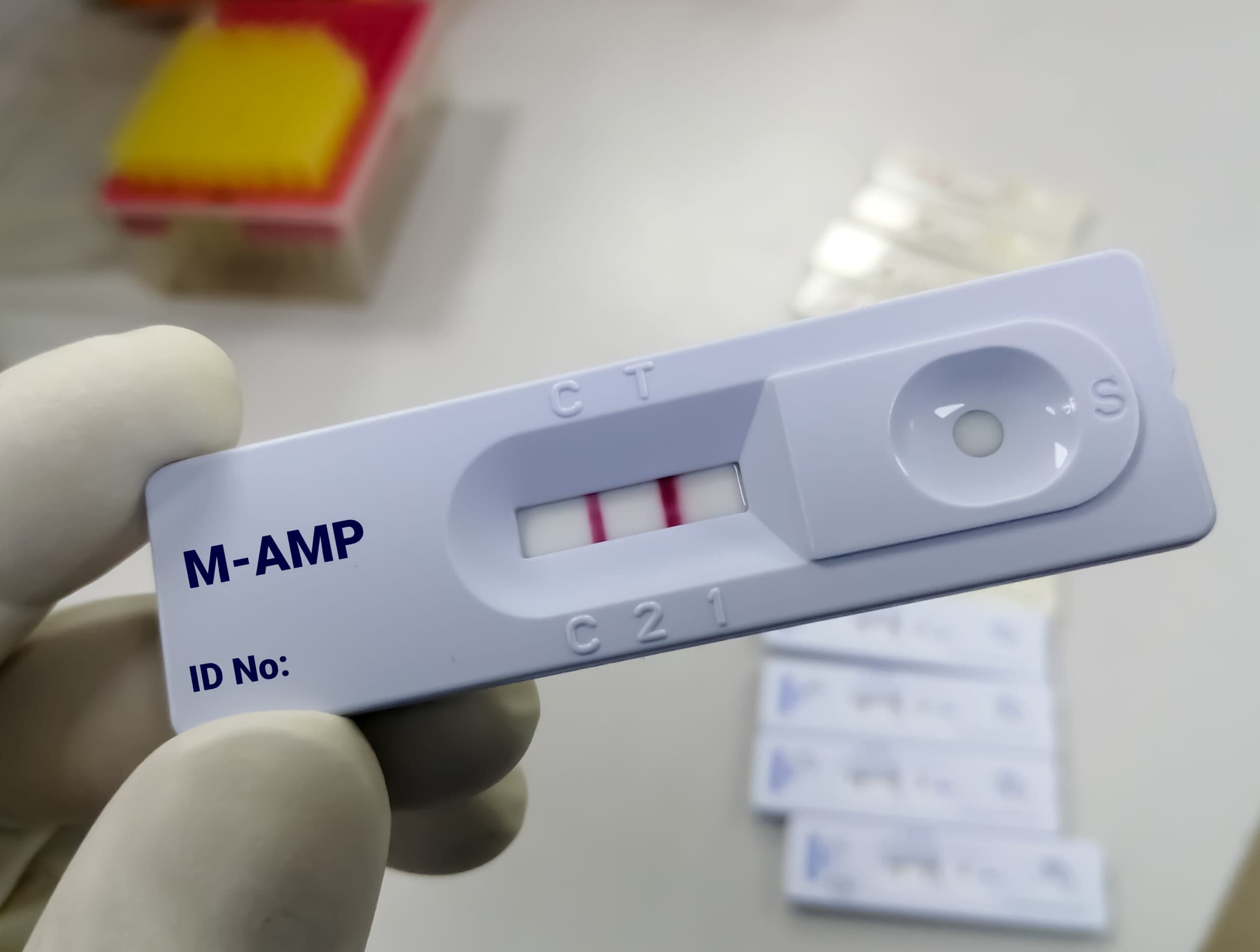 amphetamine drug test