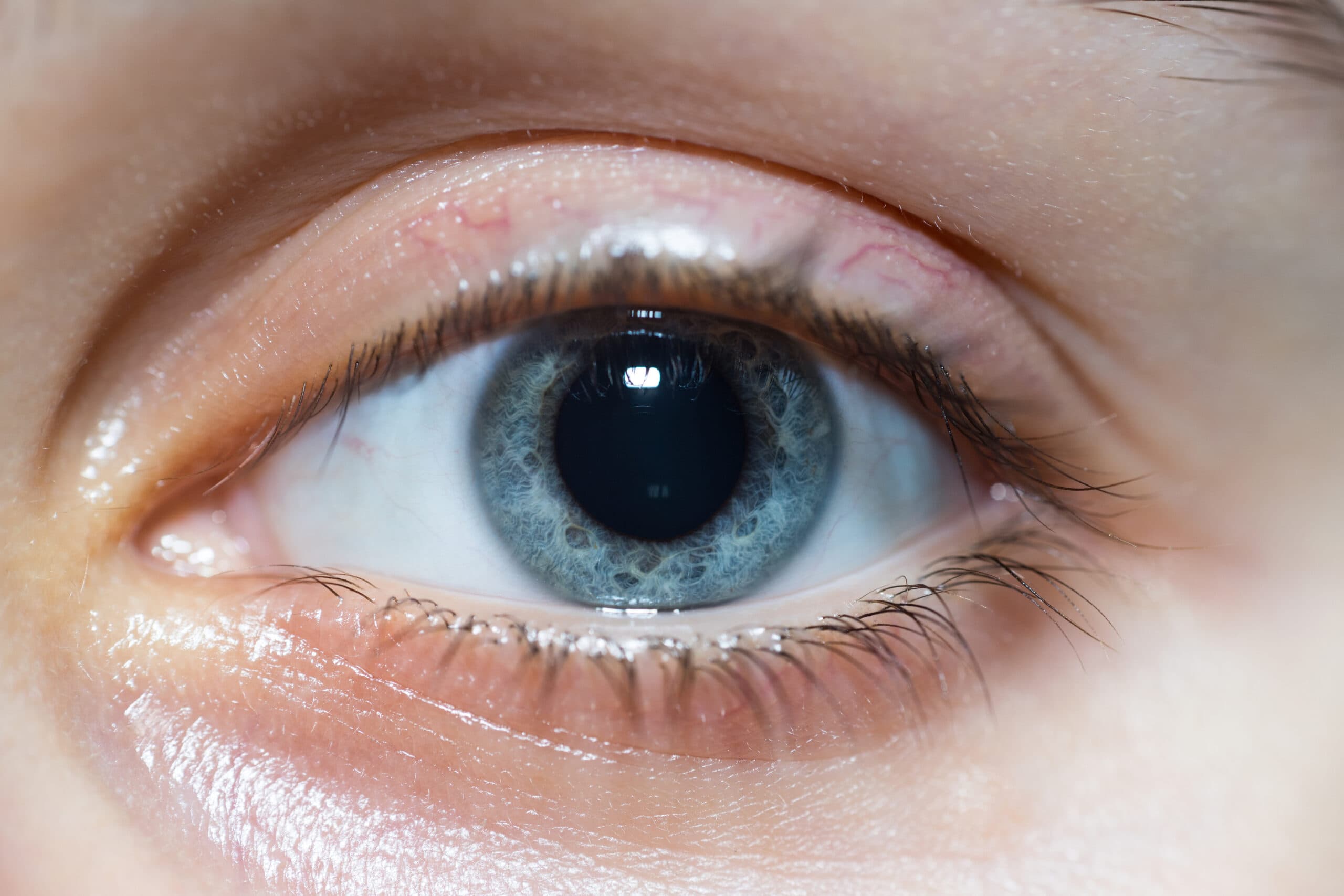 The truth about blue eyes: everything you need to know - Glasses Direct Blog