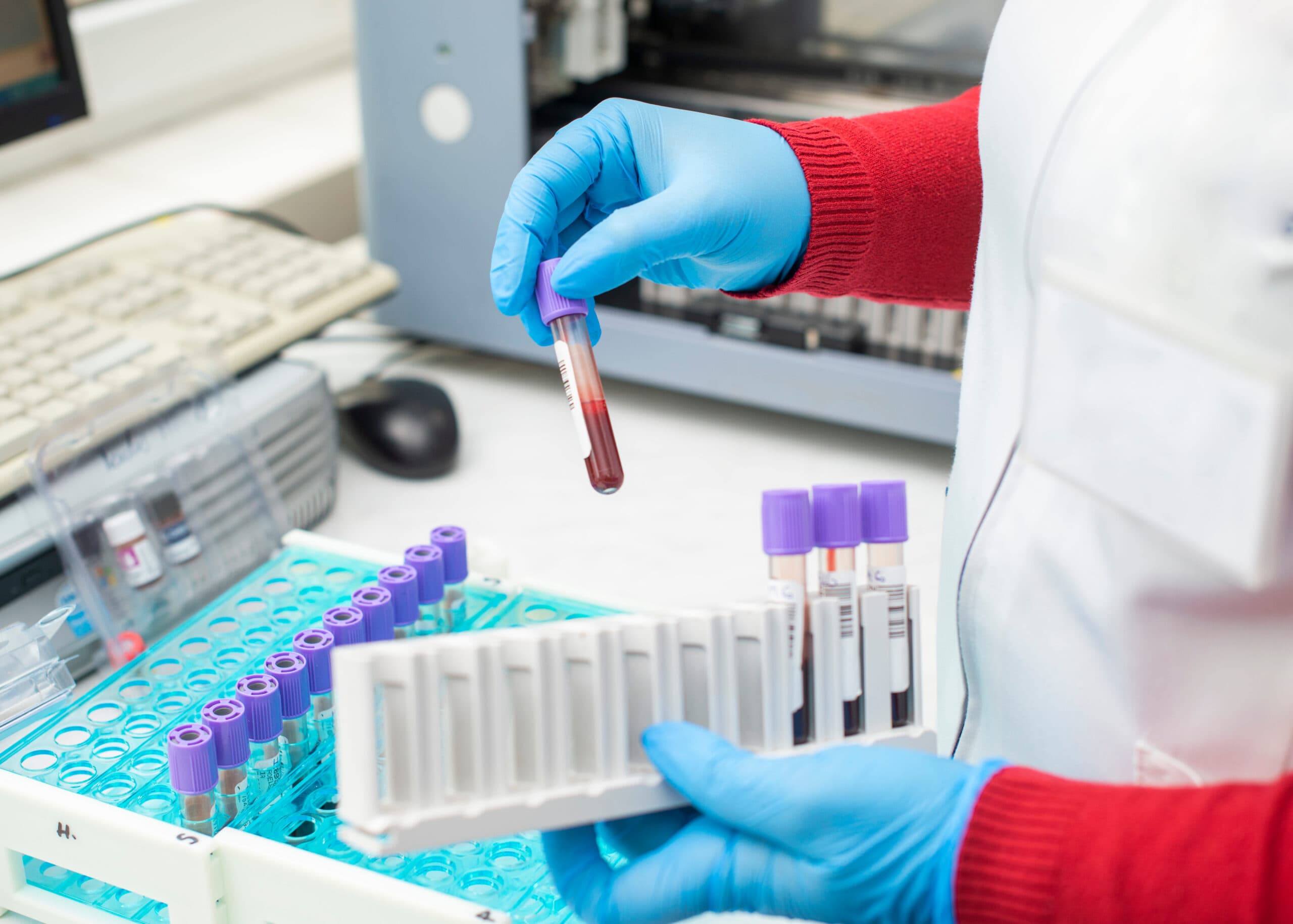 lab worker with blood drug test vial