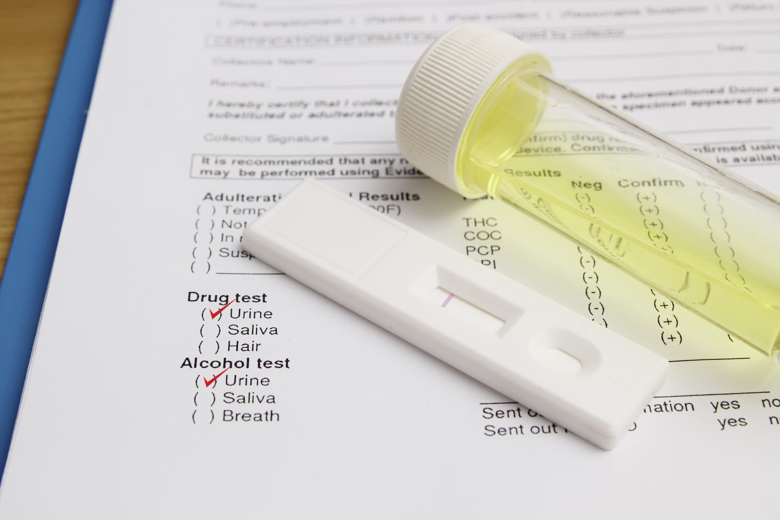 urine drug test results