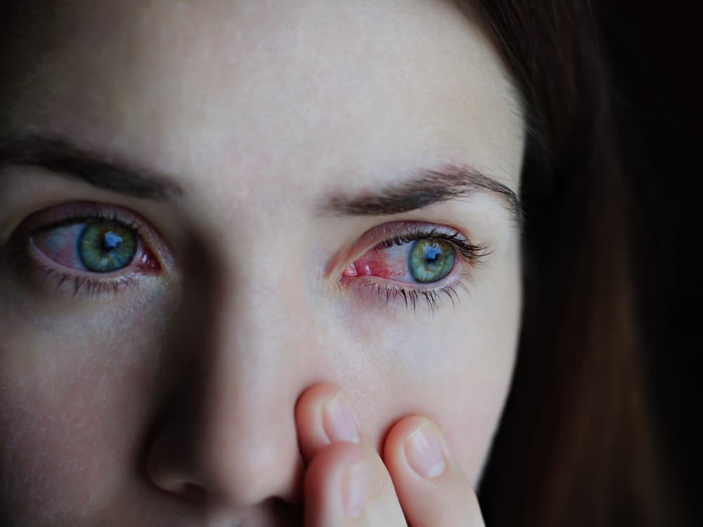 woman with stoned eyes high on cannabis