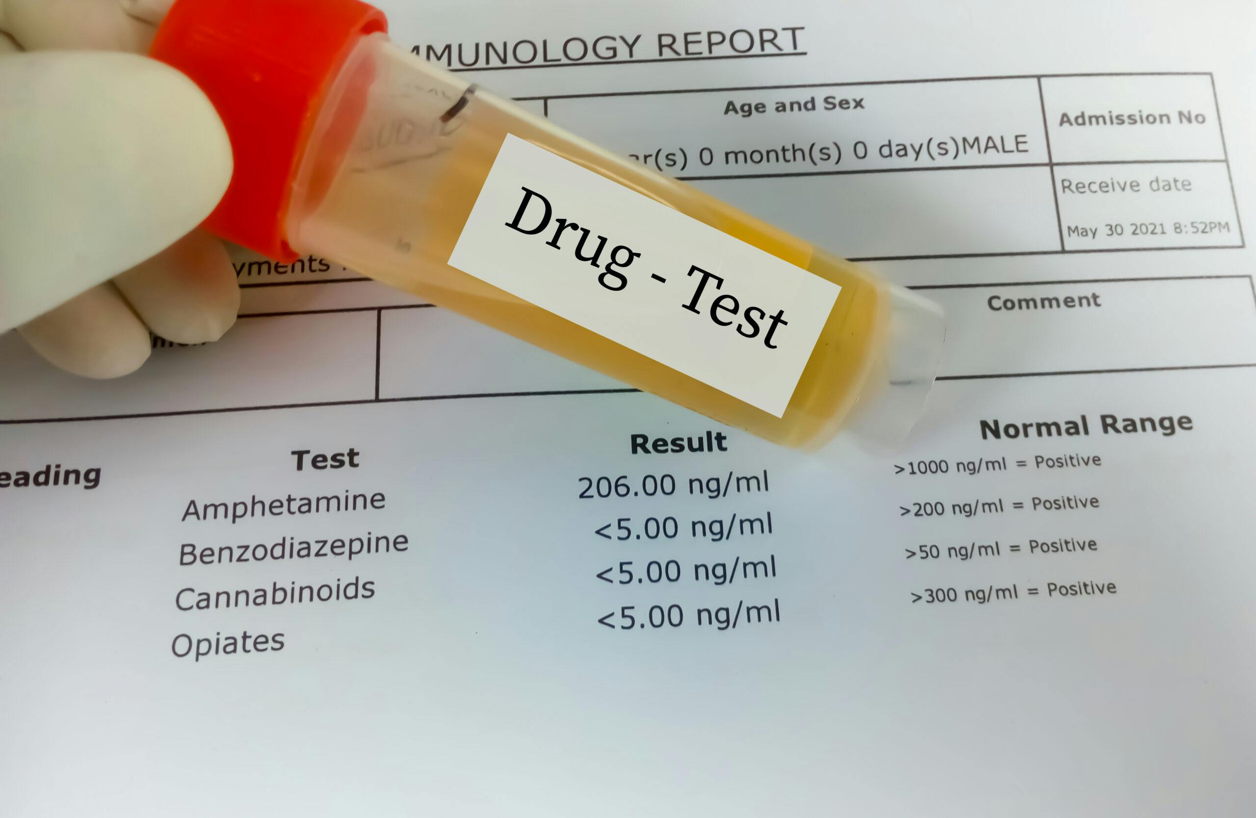 urine drug test for benzos