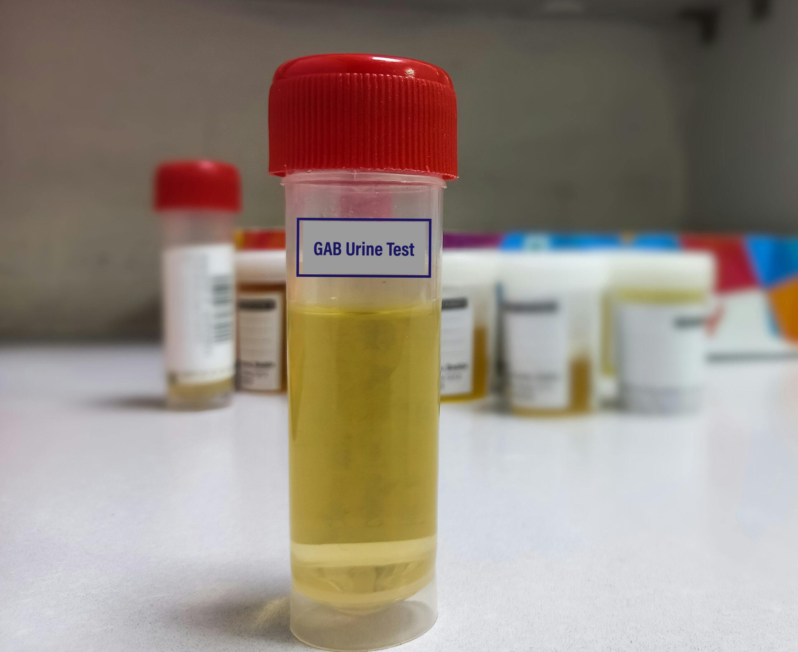 urine sample gabapentin drug test