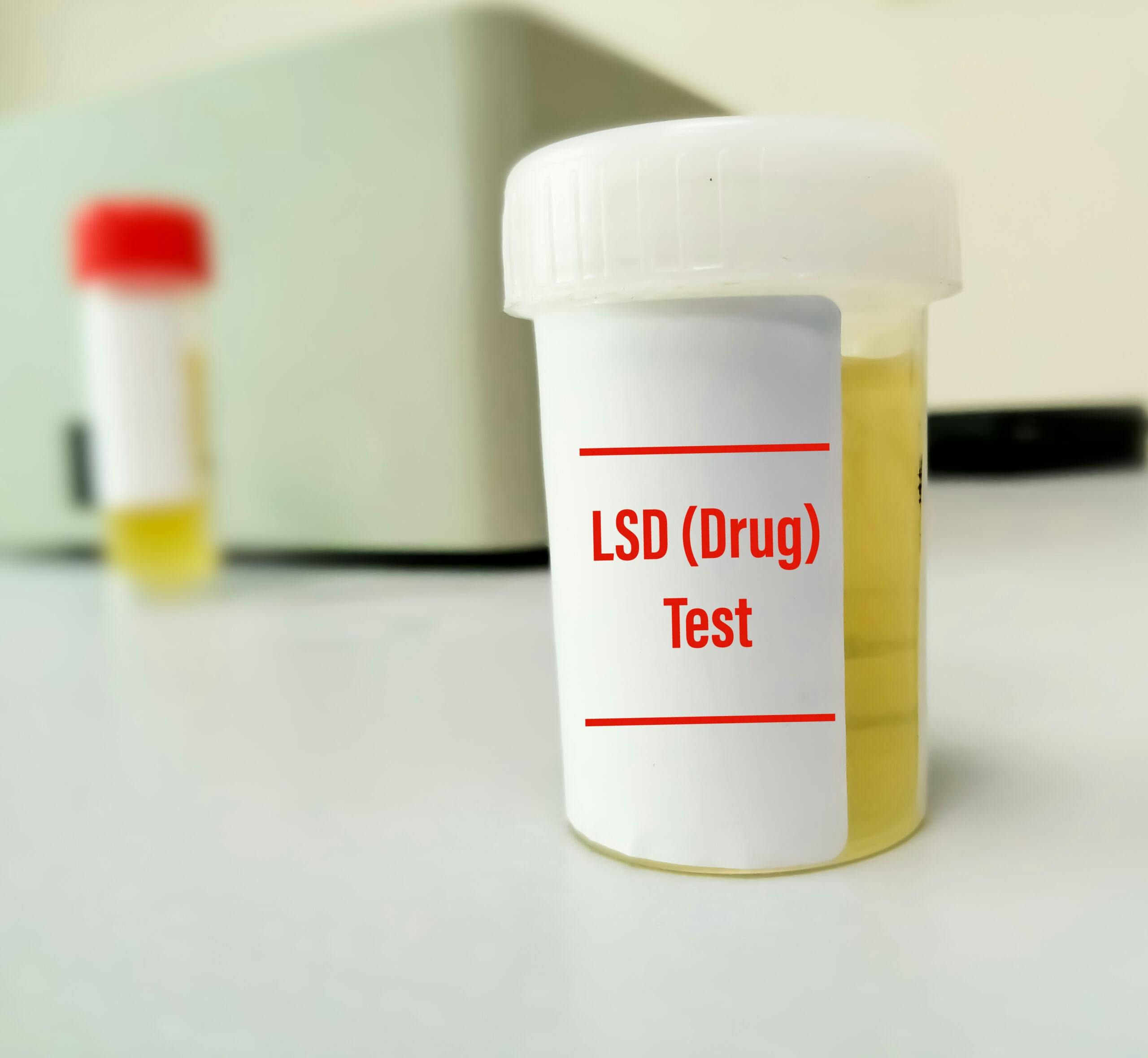 lsd drug test urine