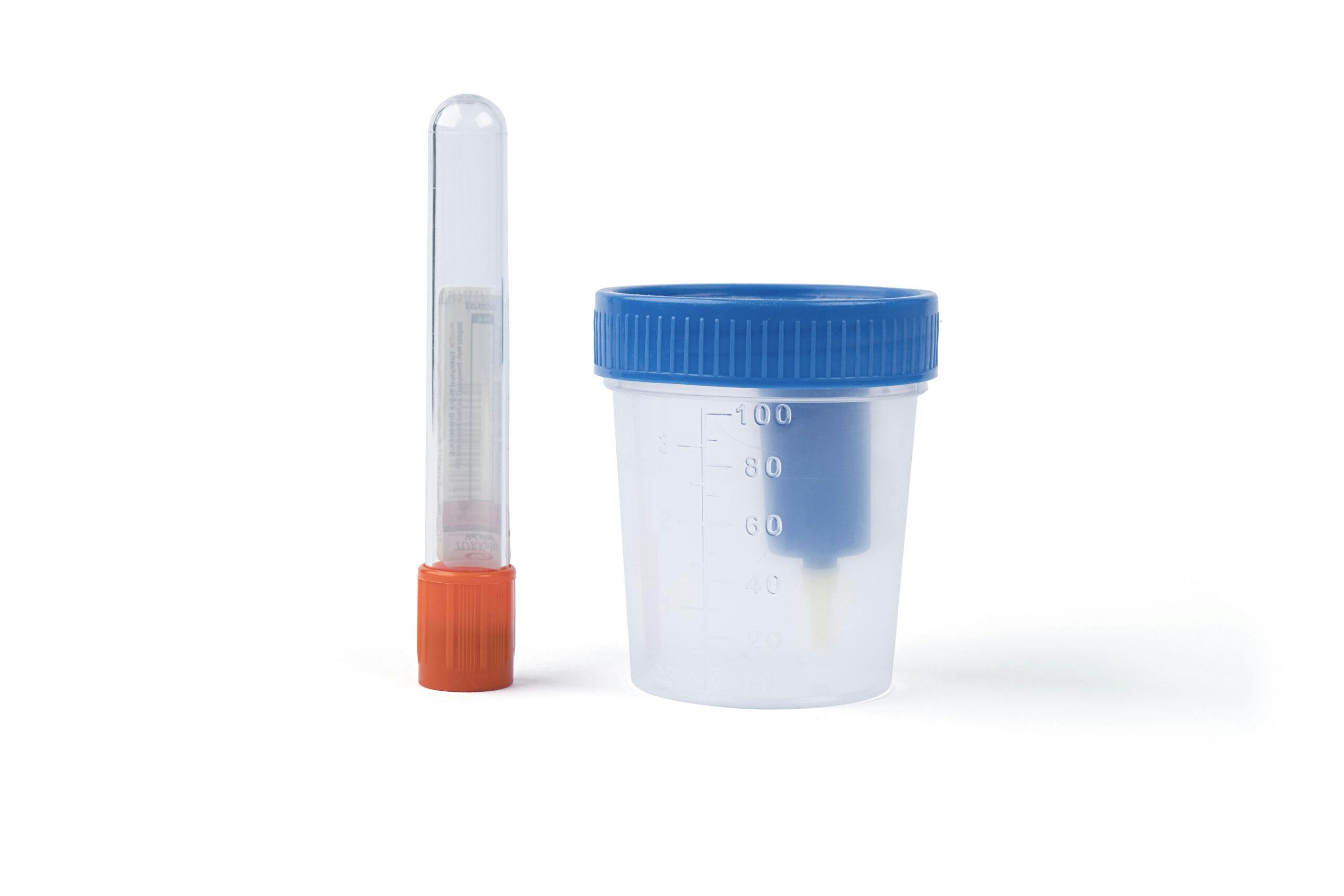 urine drug test blood test