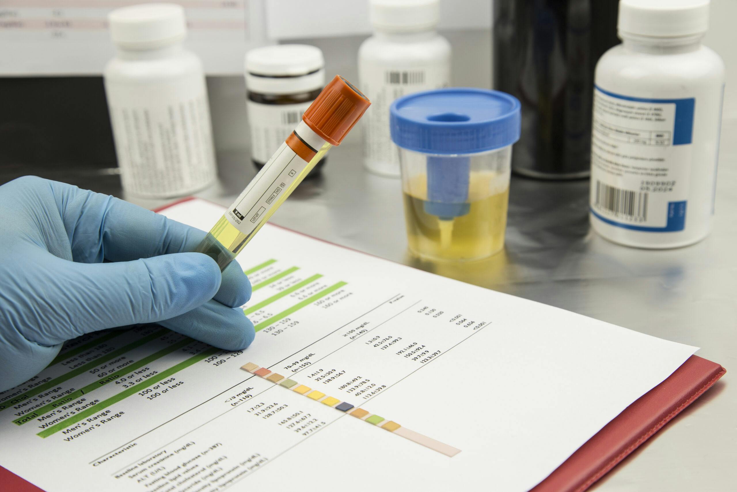 percocet panel urine drug test