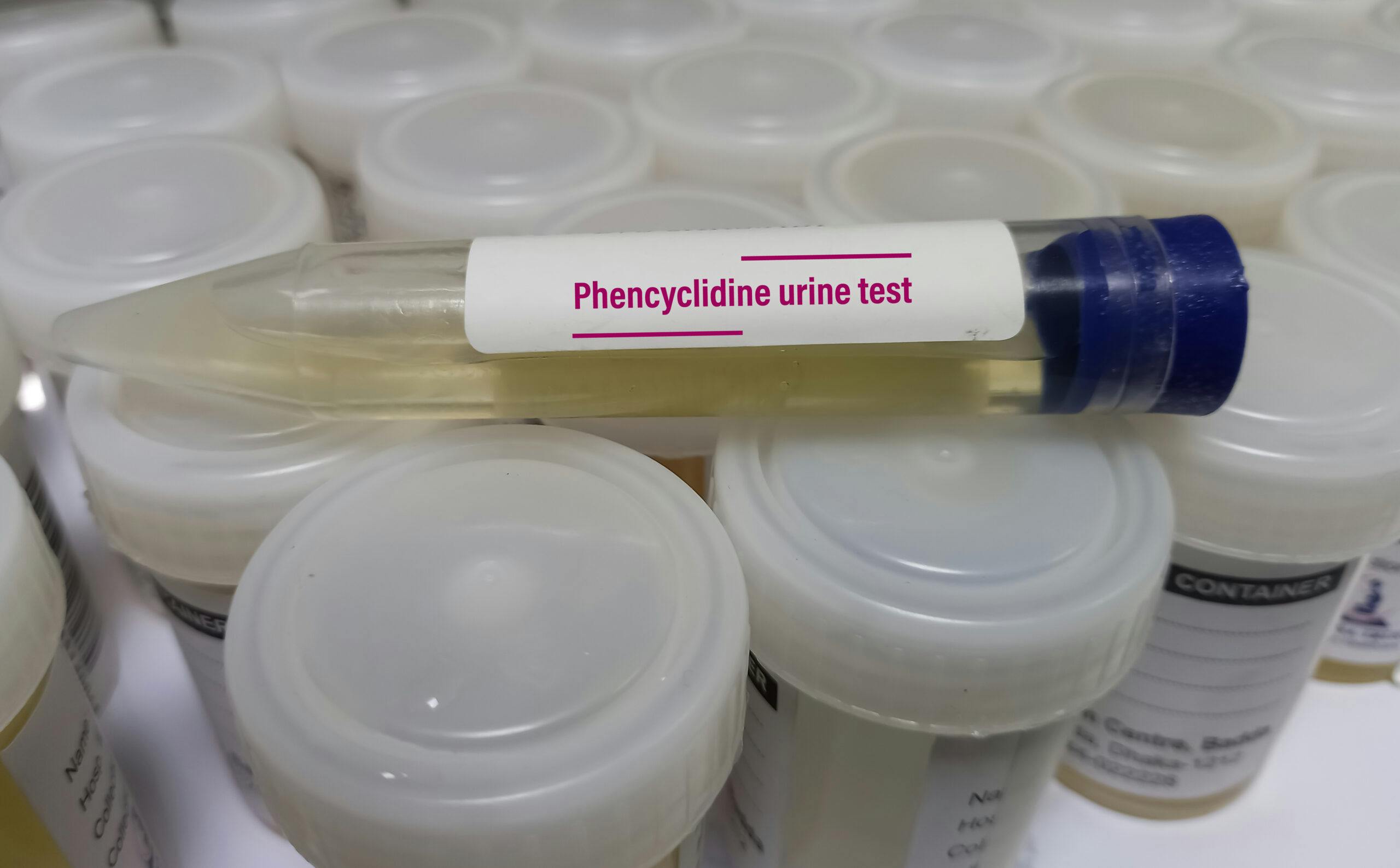 Phencyclidine pcp urine drug test