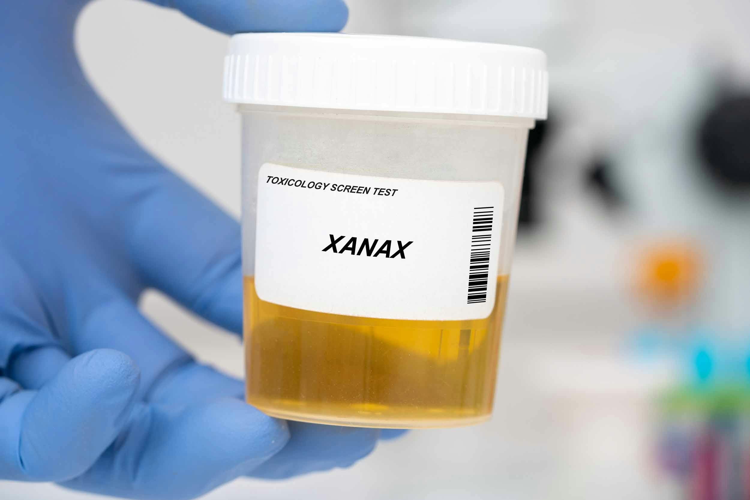 xanax urinalysis drug test