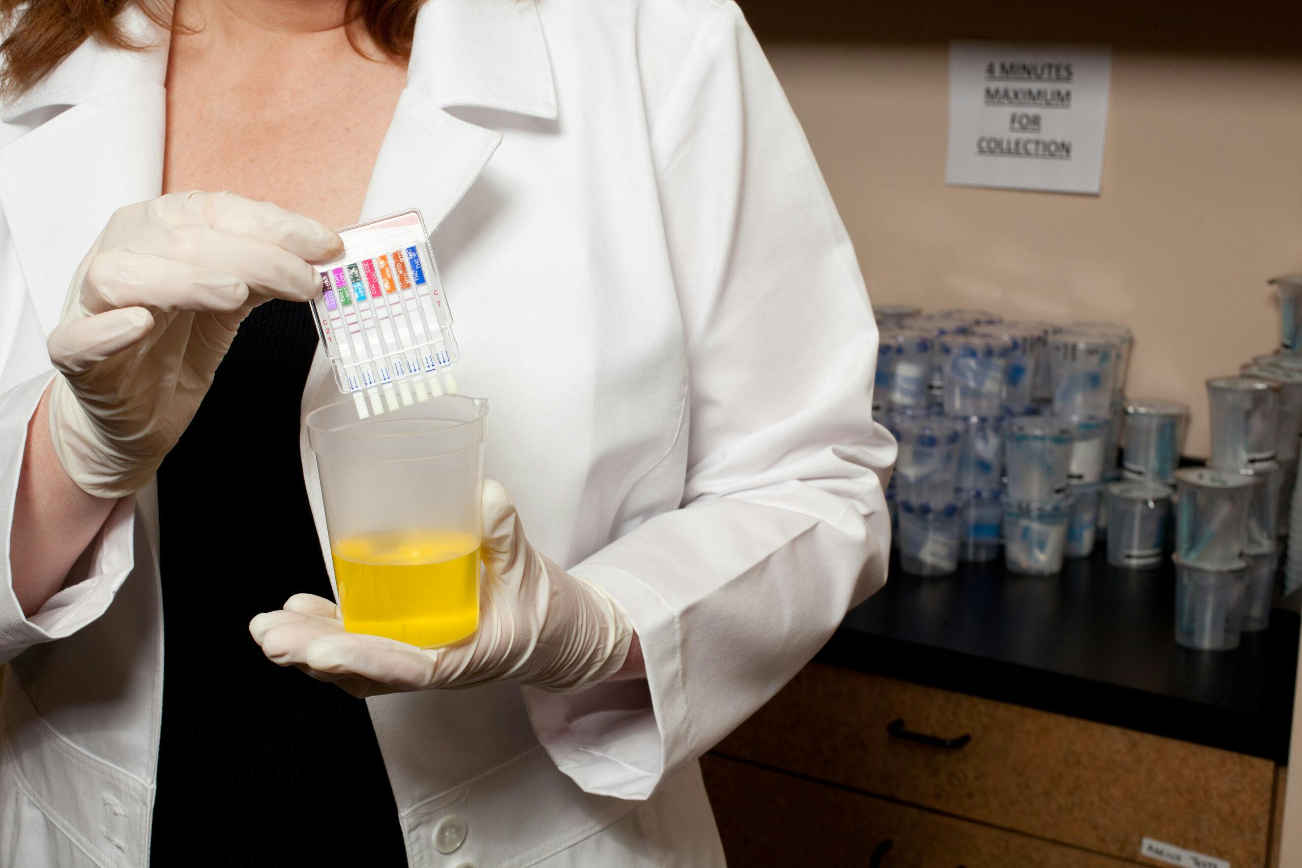 doctor holding urine drug test