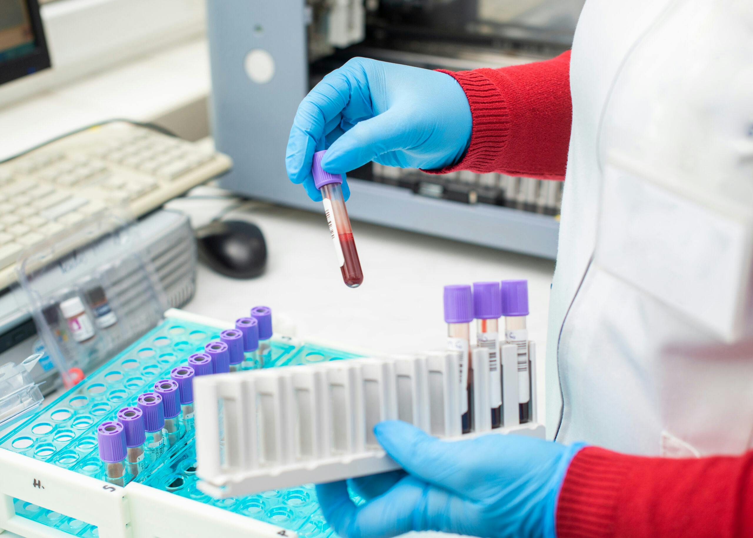 lab worker with blood drug test vial