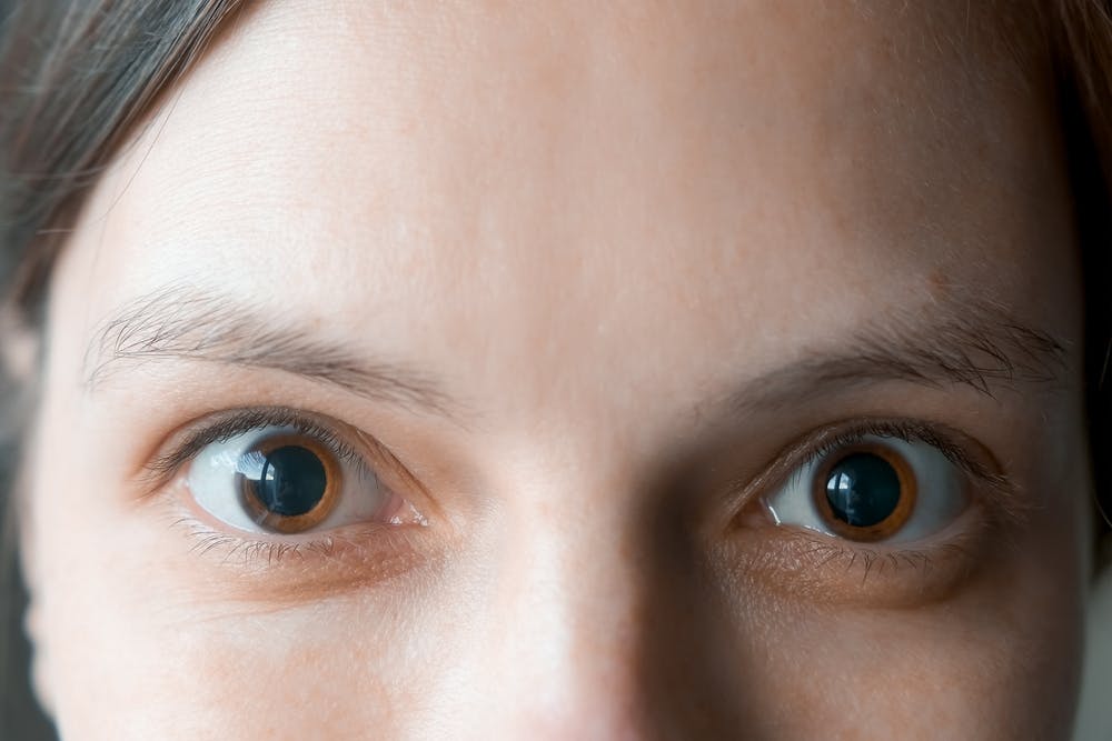 woman with large pupils